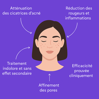 Masque LED Thérapie Lumière – Soin visage professionnel à domicile