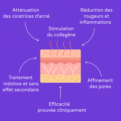 Masque LED Thérapie Lumière – Soin visage professionnel à domicile